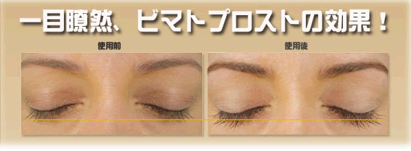 ディアベラ(dea bella)アイラッシュコンディショナー激安通販